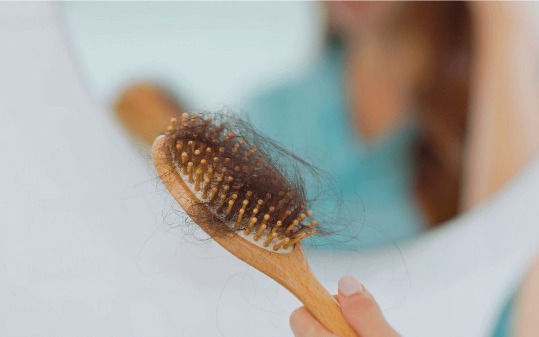 How To Treat Hair Loss